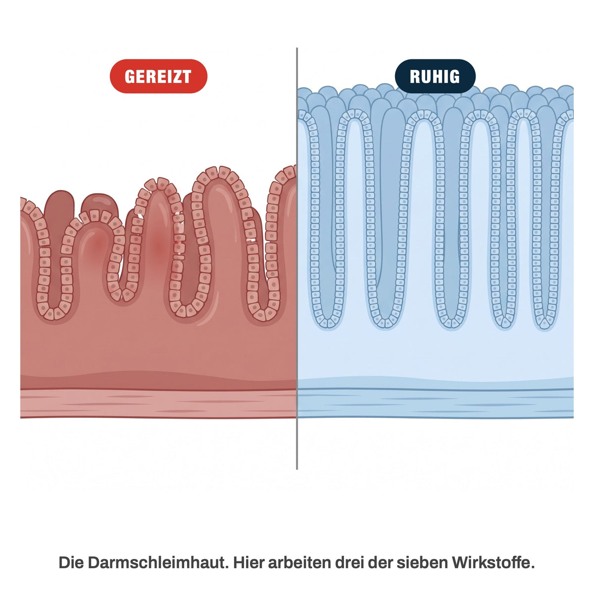 Darmschleimhaut gereizt und ruhig im Vergleich: hier arbeiten drei der sieben Wirkstoffe